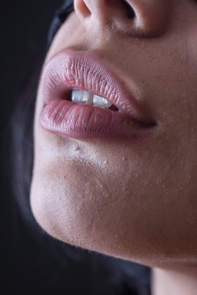 home remedies for dry lips and chapped lips naturally
